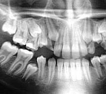 Foto 3 de Dentadente®-Medicina Dentária