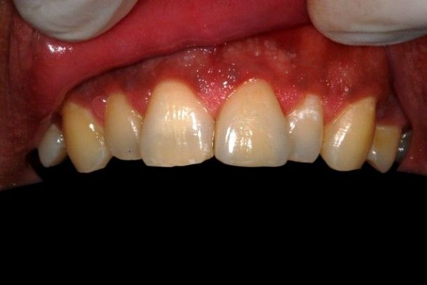 Foto 2 de Remfixa- Prótese Dentária, Unipessoal Lda
